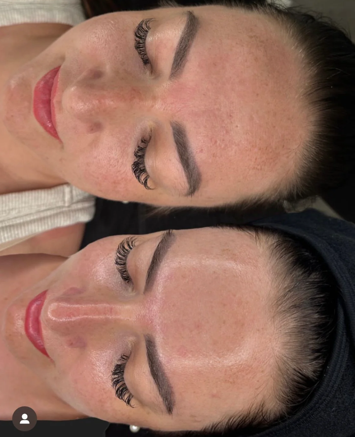 LACTIC BRIGHTENING PEEL 40%, pH 2.9 50 мл