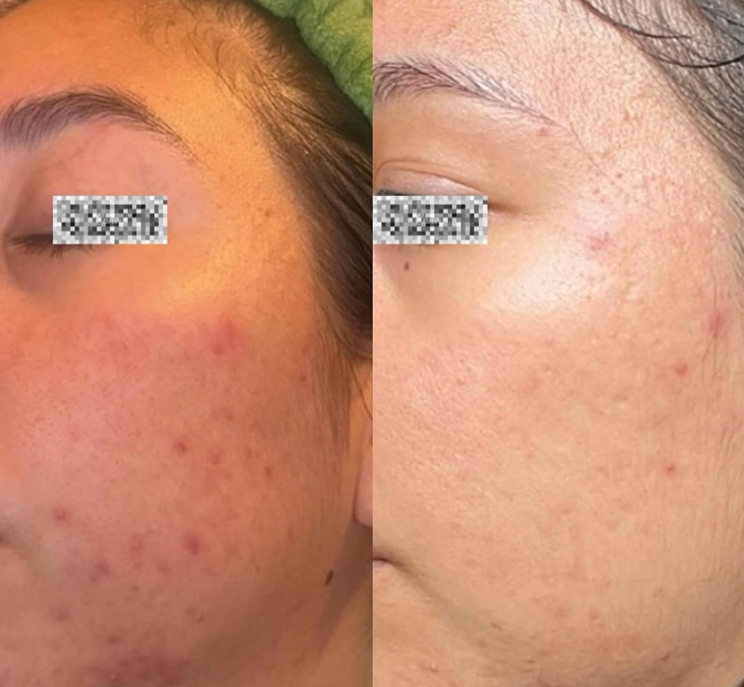 MELA DEFENSE WHITENING SERUM 30 г