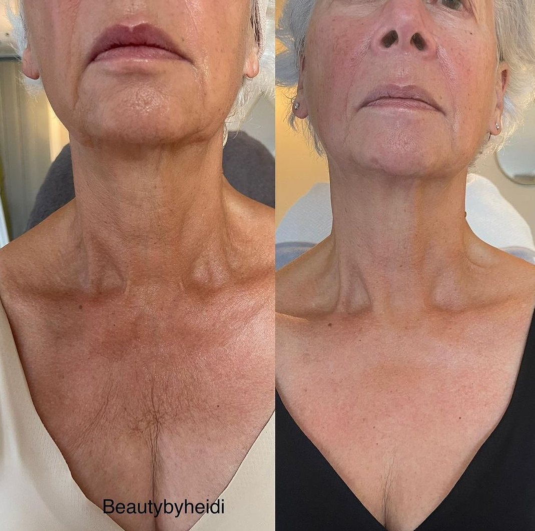 NECK LIFT CREAM 50 g
