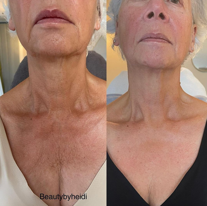 NECK LIFT CREAM 50 g.