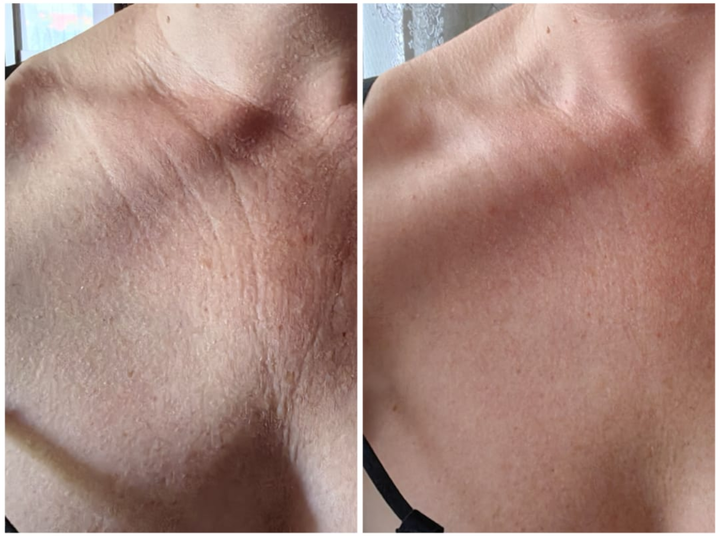 NECK LIFT CREAM 50 g