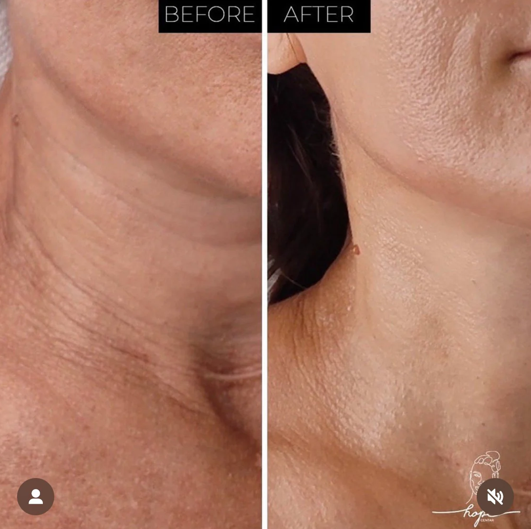 NECK LIFT CREAM 50 g