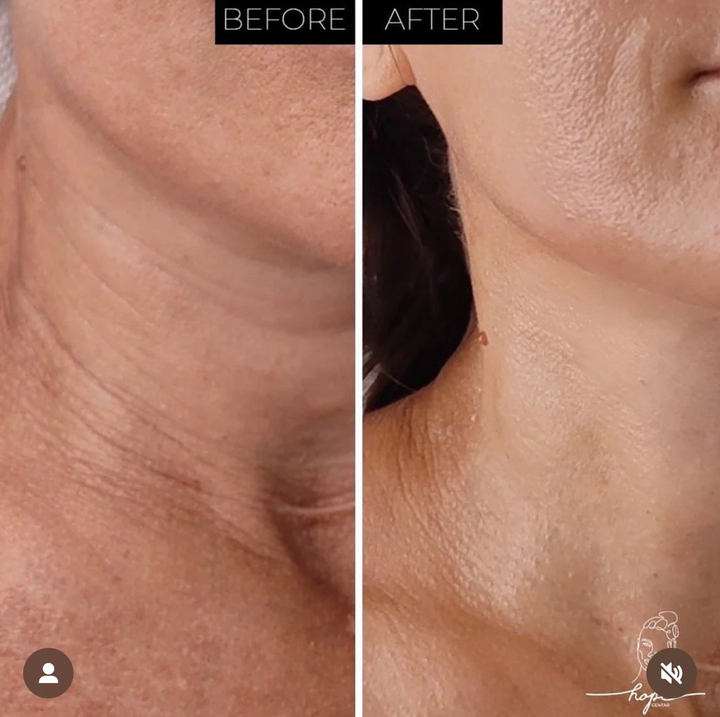 NECK LIFT CREAM 50 g