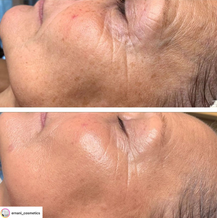 V-TOX LIFT MASK 100 ml